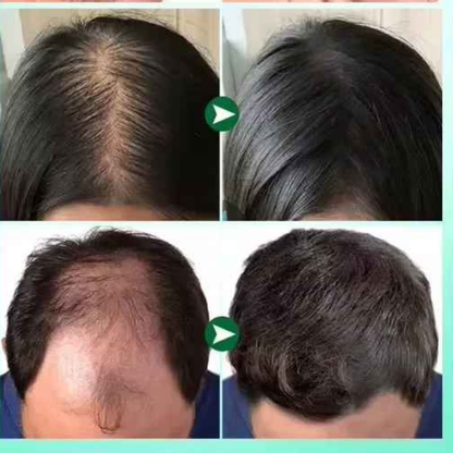 ROSMARY ESSENTIAL GROWTH OIL & DERMAROLLER